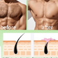 Careve Hair Removal Spray – Painless & Easy Hair Removal Solution for Smooth Skin